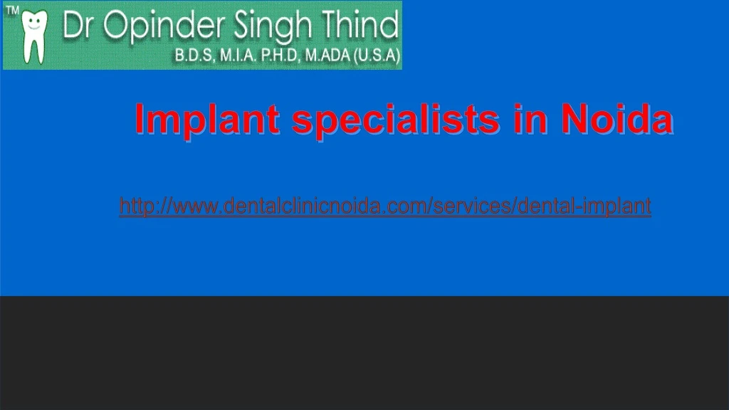 implant specialists in noida