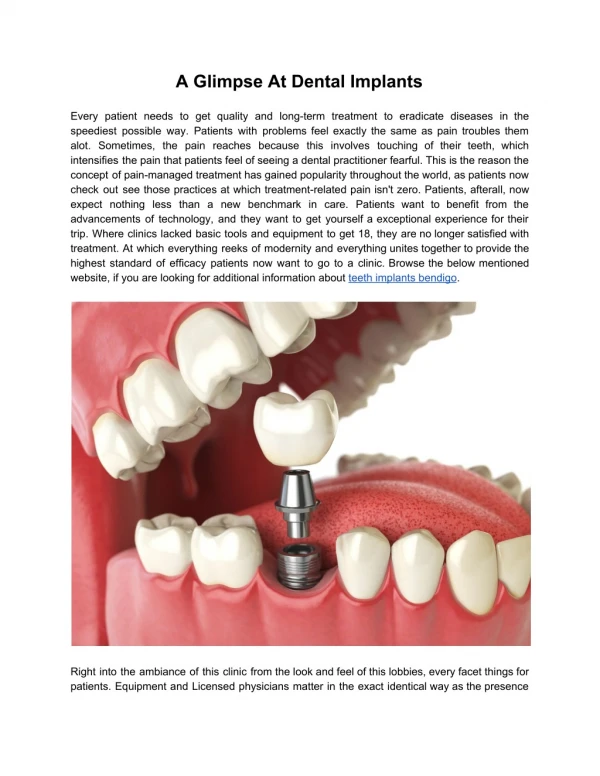 A Glimpse At Dental Implants