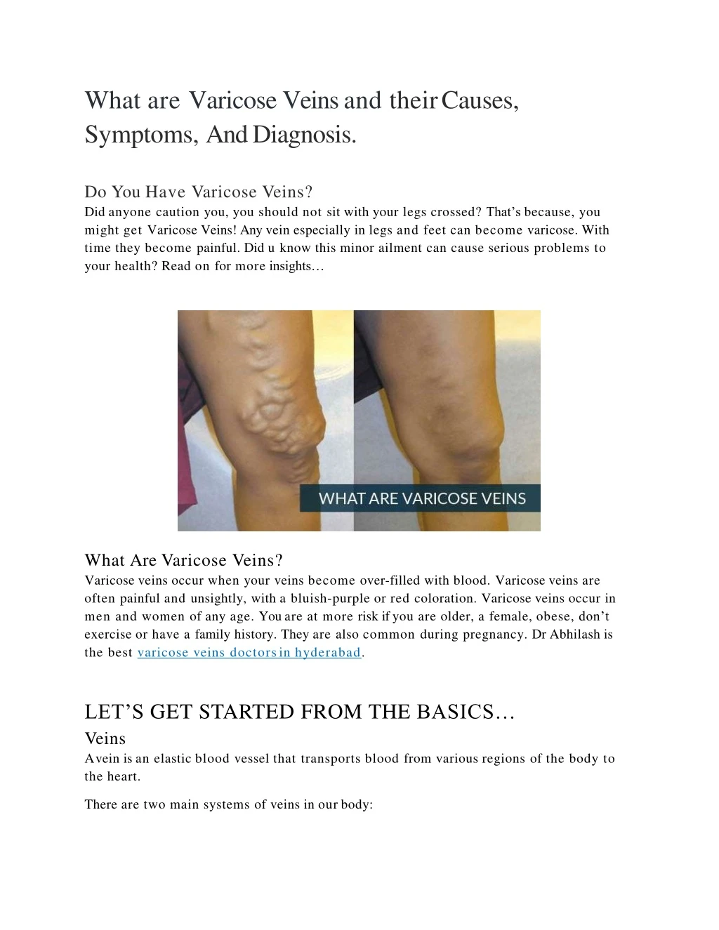 what are varicose veins and their causes symptoms and diagnosis