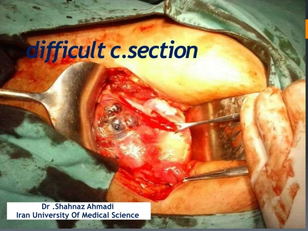 difficult c.section