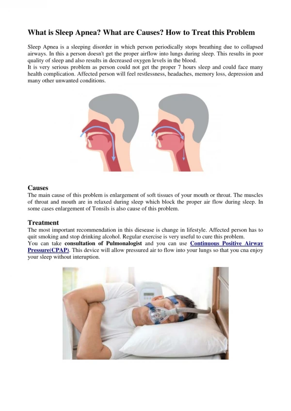 What is Sleep Apnea? What are Causes? How to Treat this Problem