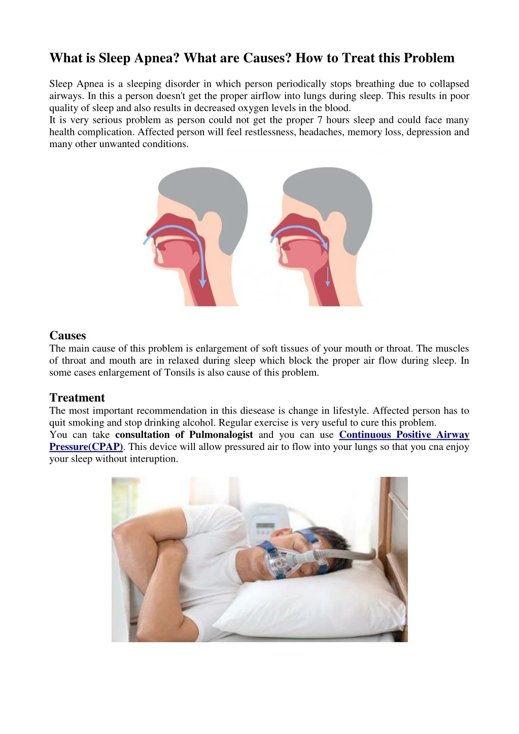 what is sleep apnea what are causes how to treat