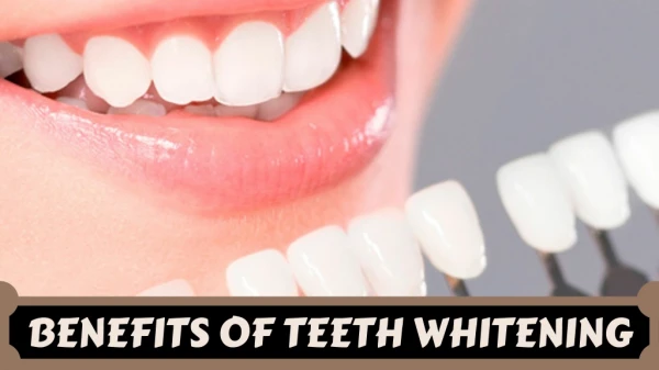 Professional Teeth Whitening