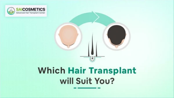 Which Type of Hair Transplant Procedures Suits You?