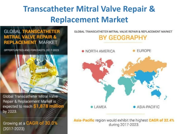 Transcatheter Mitral Valve Repair & Replacement Market Statistics