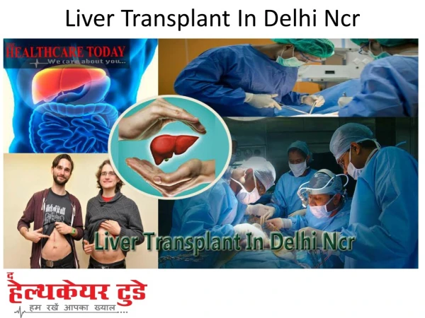 Liver Transplant In Delhi Ncr