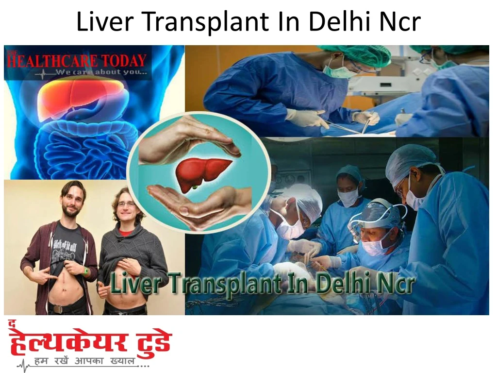 liver transplant in delhi ncr