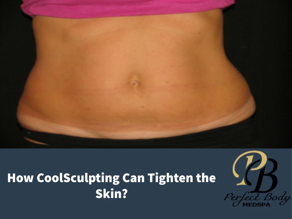 how coolsculpting can tighten the skin