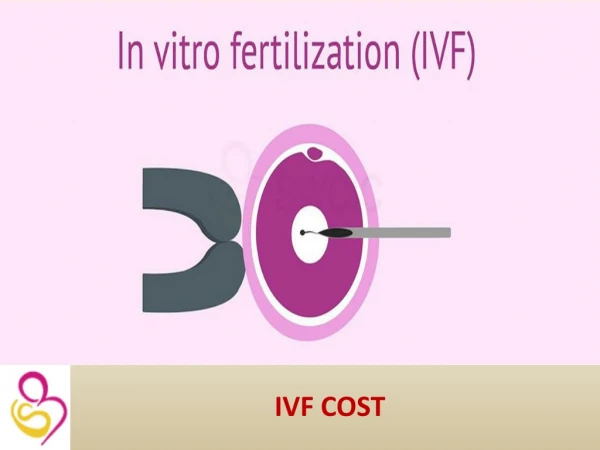 IVF Cost