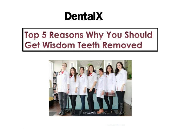 Top 5 Reasons Why You Should Get Wisdom Teeth Removed