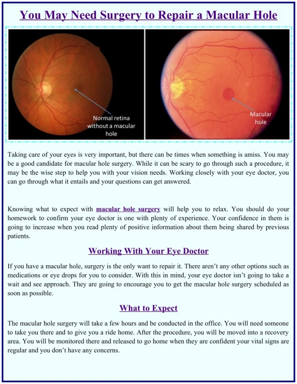 You may need Surgery to Repair a Macular Hole