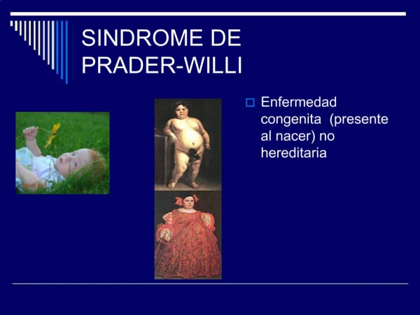 SINDROME DE PRADER-WILLI