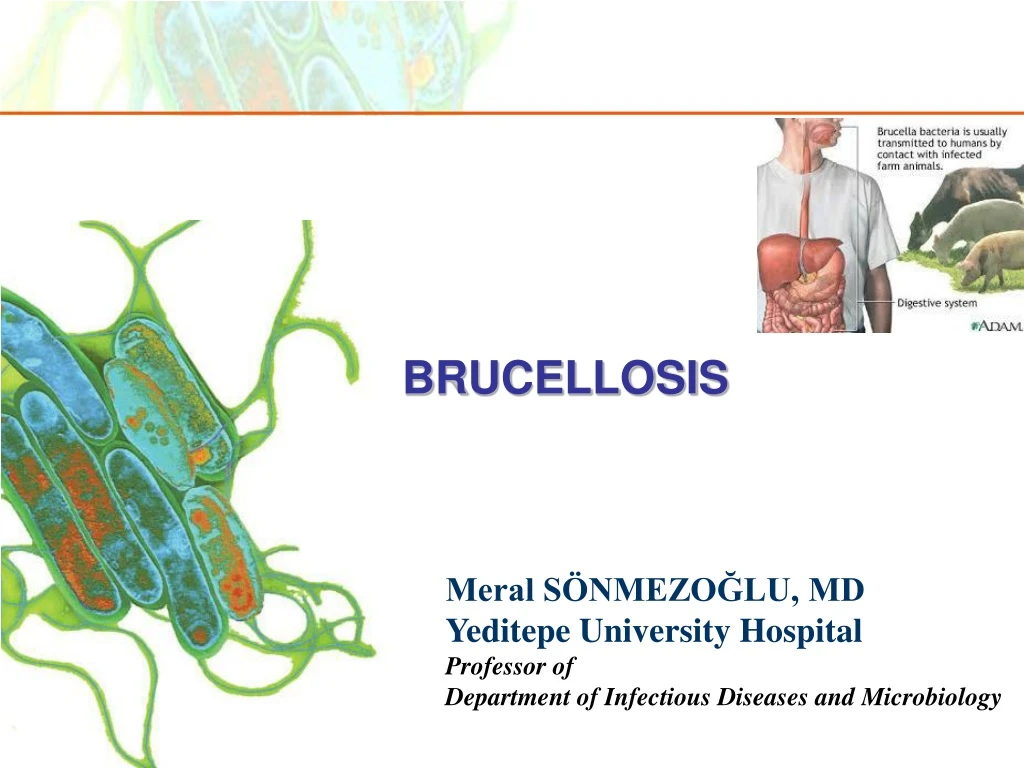 brucellosis