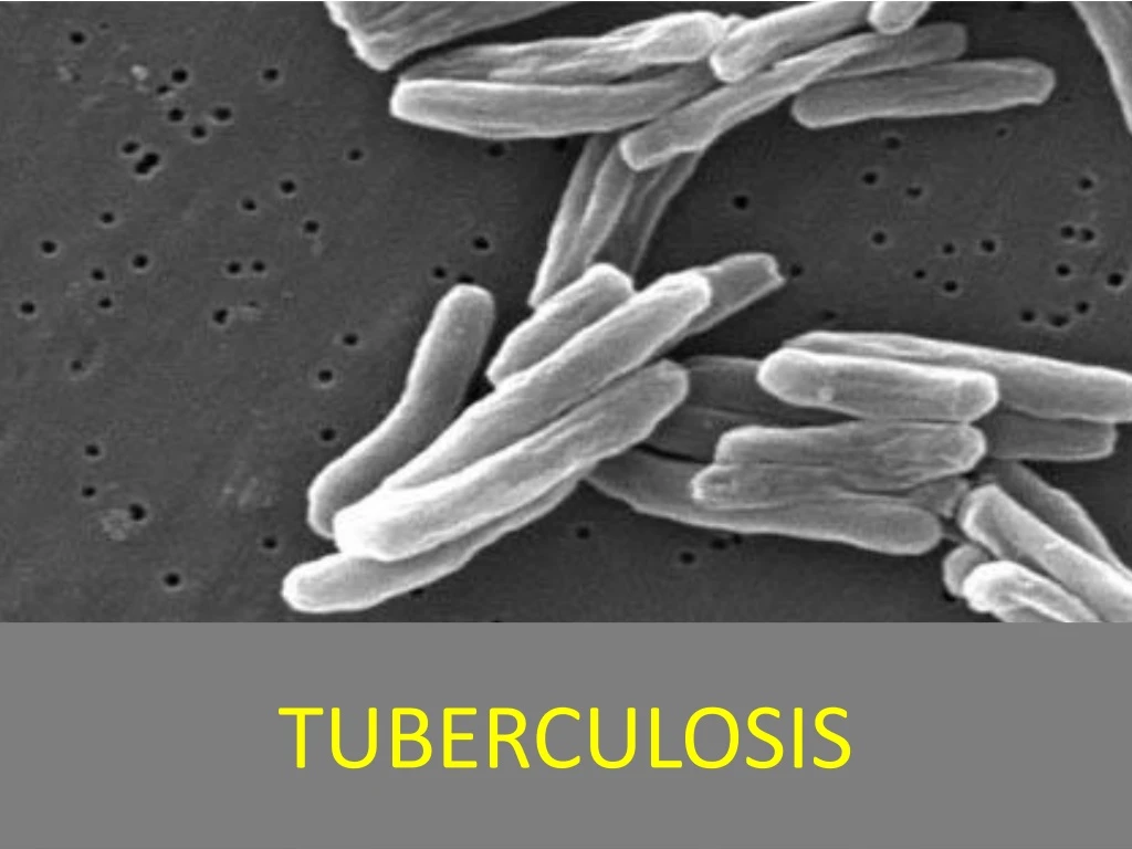 tuberculosis