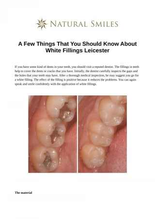 A Few Things That You Should Know About White Fillings Leicester - slide 1