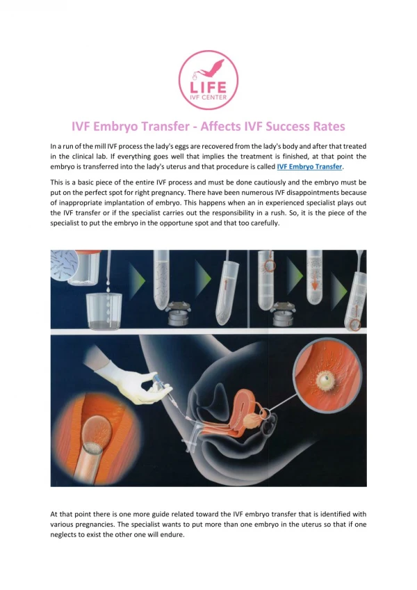 IVF Embryo Transfer - Affects IVF Success Rates