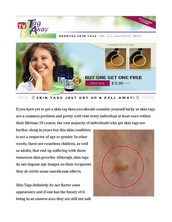 Tag Away - Proven Effective Natural Skin Tag Remover