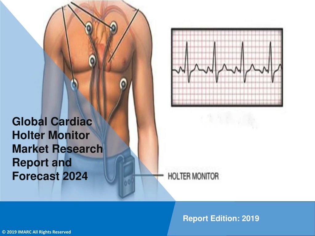 global cardiac holter monitor market research
