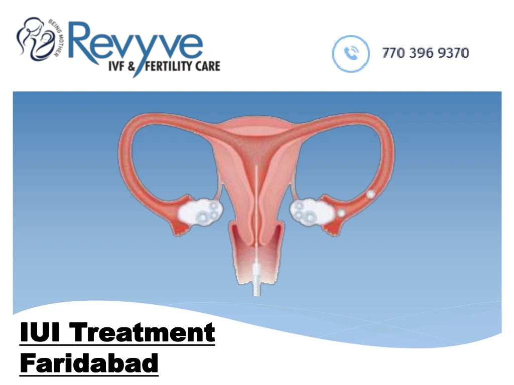 iui treatment faridabad