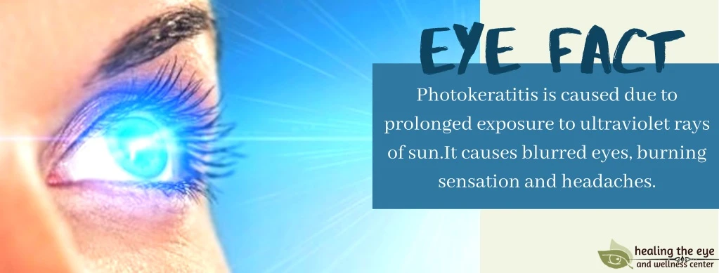 eye fact photokeratitis is caused