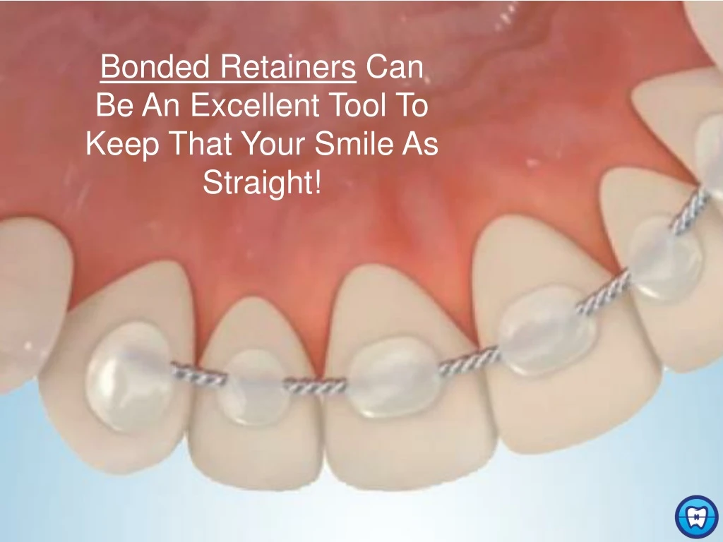 bonded retainers can be an excellent tool to keep that your smile as straight