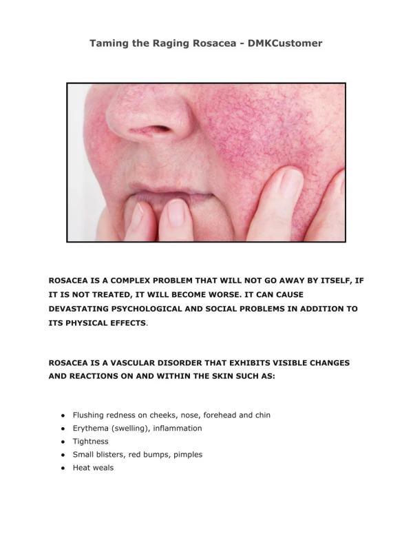 Taming the Raging Rosacea - DMKCustomer