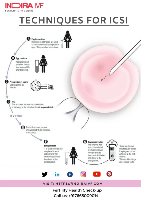 What techniques can be used for ICSI - Indira IVF