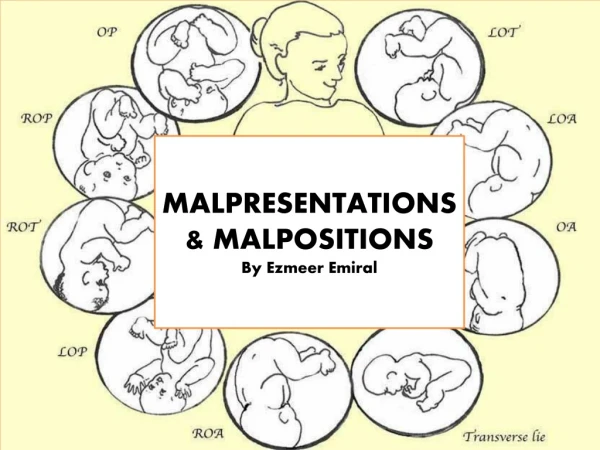 MALPRESENTATIONS &amp; MALPOSITIONS By Ezmeer Emiral