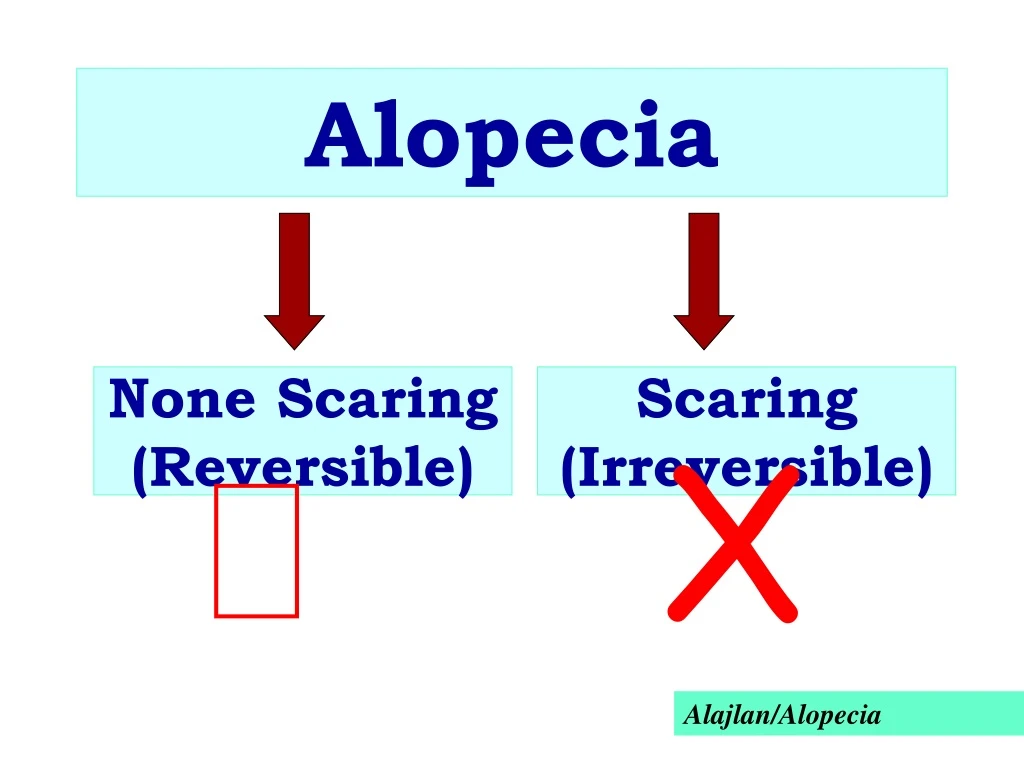 alopecia