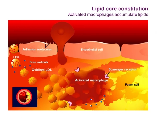 Lipid core constitution Activated macrophages accumulate lipids