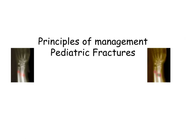 Principles of management Pediatric Fractures
