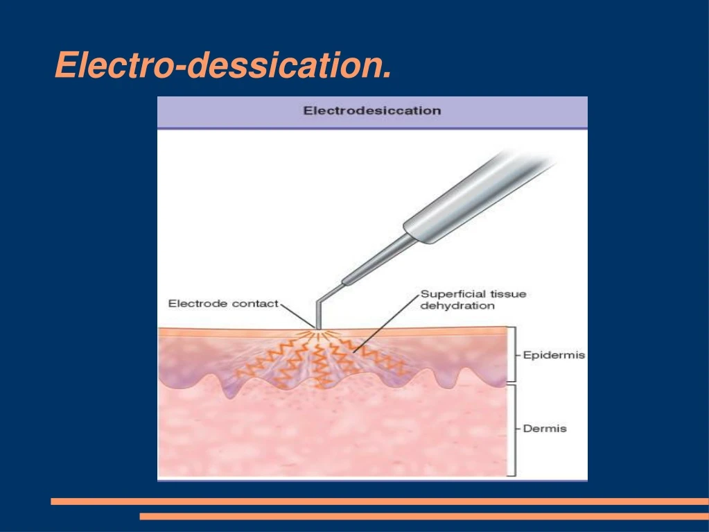 electro dessication