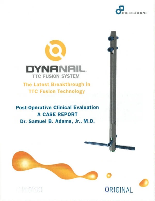 DynaNail® TTC Fusion System - Post-Operative Clinical Evaluation Case Report By Dr. Samuel B. Adams, Jr., M.D.