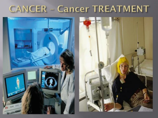 CANCER – Cancer TREATMENT