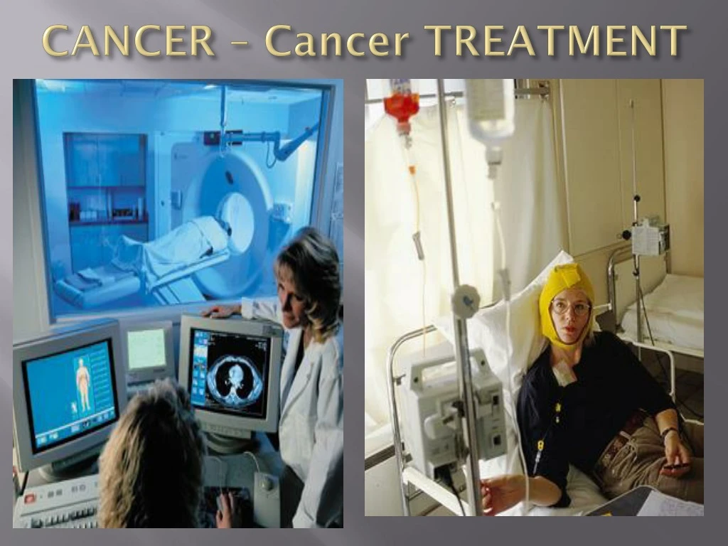 cancer cancer treatment