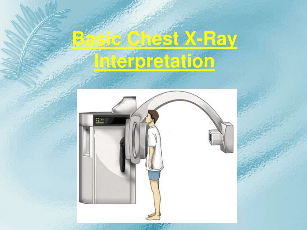 basic chest x ray interpretation