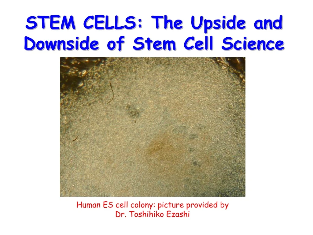 stem cells the upside and downside of stem cell