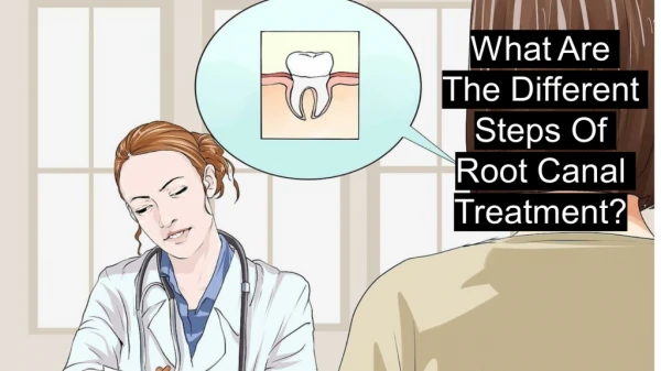 What Are The Different Steps Of Root Canal?
