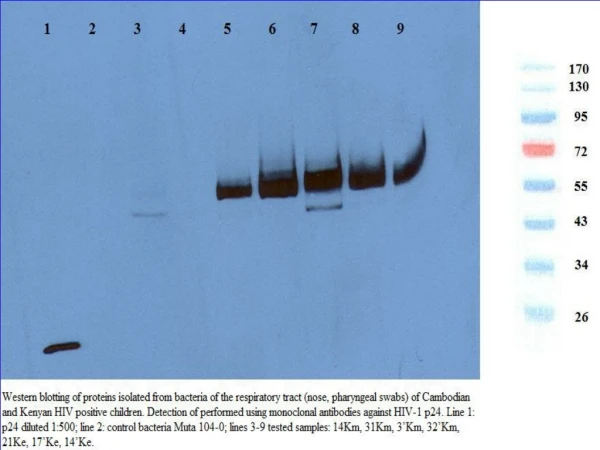 Western blotting of proteins isolated from bacteria and yeasts of the respiratory tract