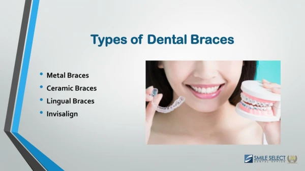 Types of Tooth Braces | Orthodontic Treatment in California