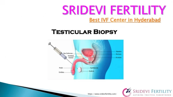 Testicular Biopsy Cost in Hyderabad | Best Male Infertility Doctors in Hyderabad