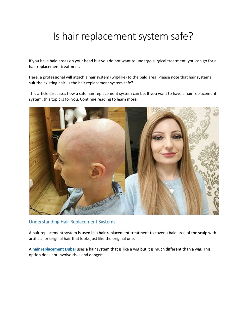 is hair replacement system safe