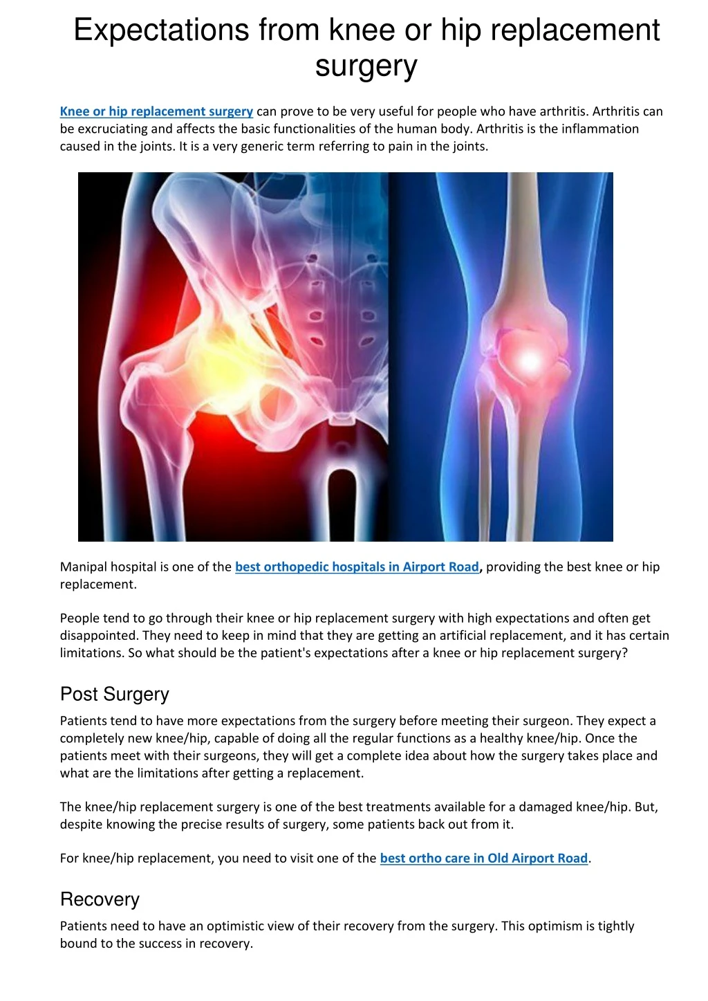 expectations from knee or hip replacement surgery