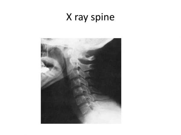 X ray spine