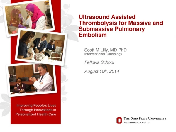Ultrasound Assisted Thrombolysis for Massive and Submassive Pulmonary Embolism