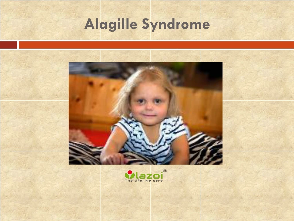 alagille syndrome