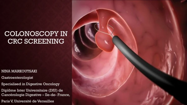 Colonoscopy in crc screening
