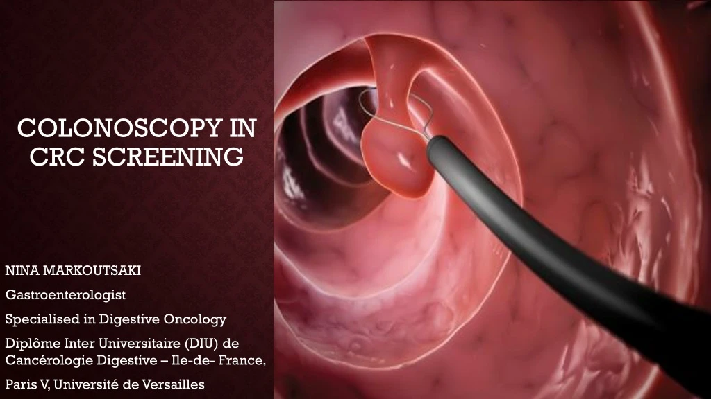 colonoscopy in crc screening