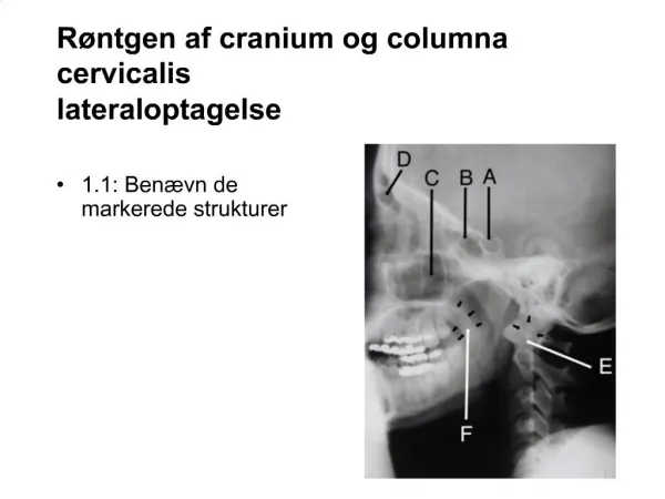 R ntgen af cranium og columna cervicalis lateraloptagelse