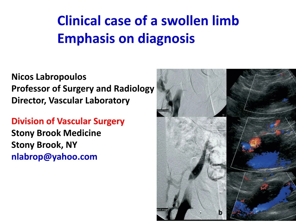 clinical case of a swollen limb emphasis